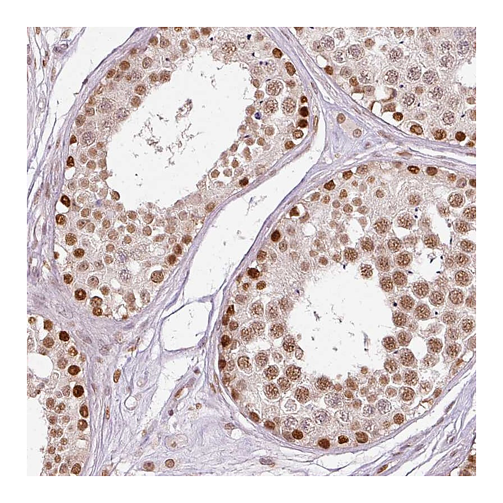 Atlas Antibodies Anti-ZNF778 Antibody
