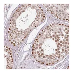 Atlas Antibodies Anti-ZNF778 Antibody