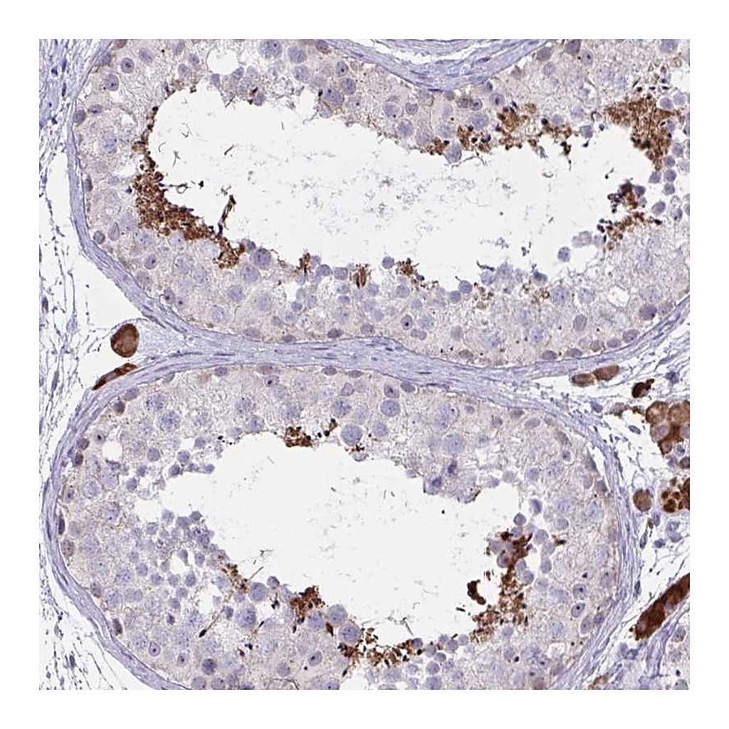 Atlas Antibodies Anti-ZNF784 Antibody