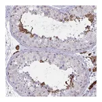 Atlas Antibodies Anti-ZNF784 Antibody
