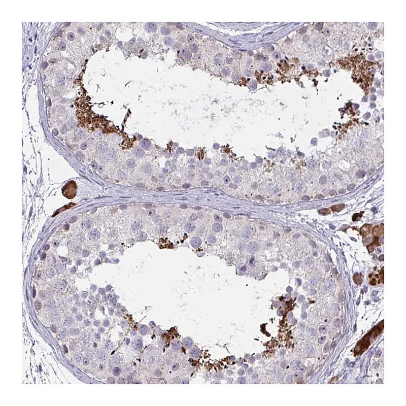 Atlas Antibodies Anti-ZNF784 Antibody