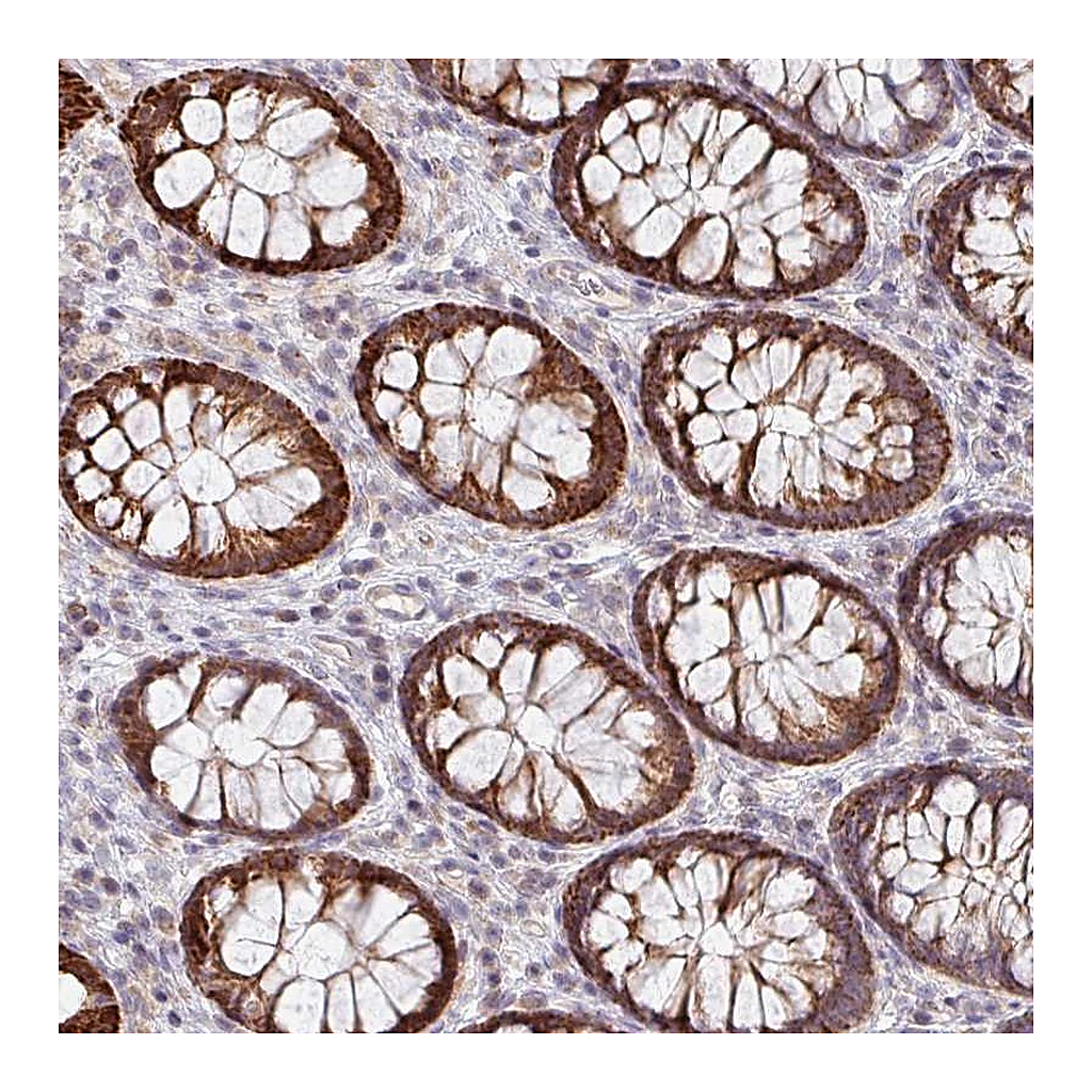 Atlas Antibodies Anti-ZNF791 Antibody