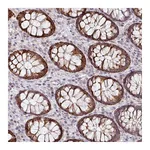 Atlas Antibodies Anti-ZNF791 Antibody