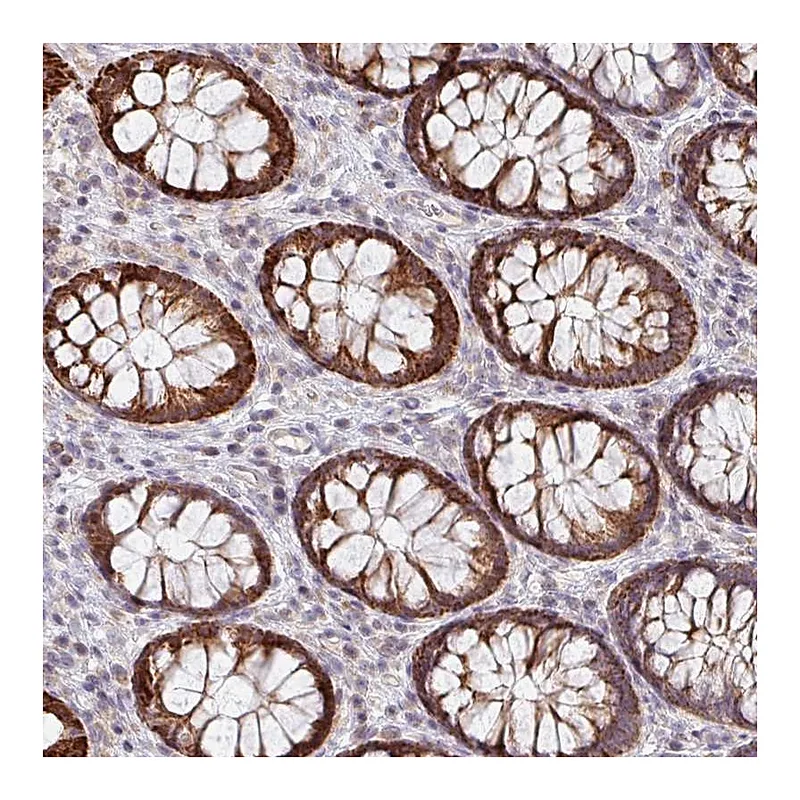 Atlas Antibodies Anti-ZNF791 Antibody