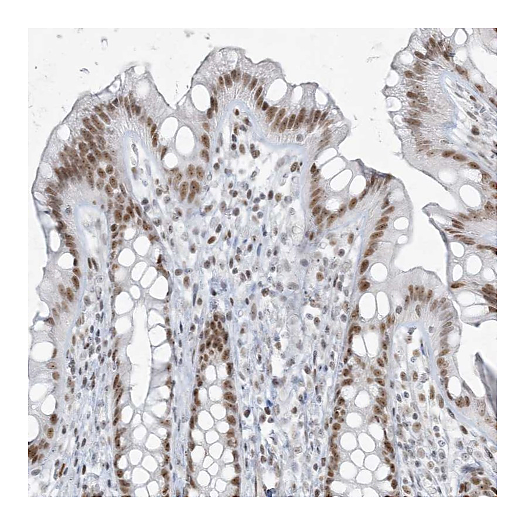 Atlas Antibodies Anti-ZNF787 Antibody