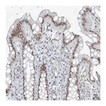 Atlas Antibodies Anti-ZNF787 Antibody