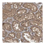 Atlas Antibodies Anti-ZNF79 Antibody