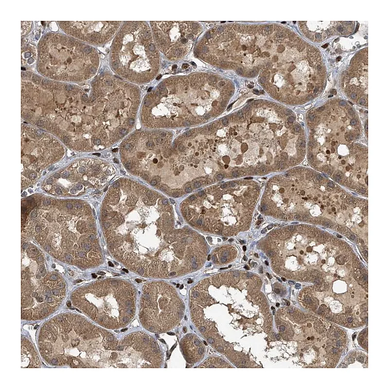 Atlas Antibodies Anti-ZNF79 Antibody