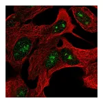 Atlas Antibodies Anti-ZNF790 Antibody