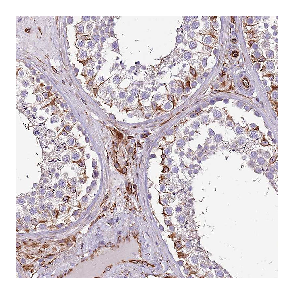 Atlas Antibodies Anti-ZNF786 Antibody