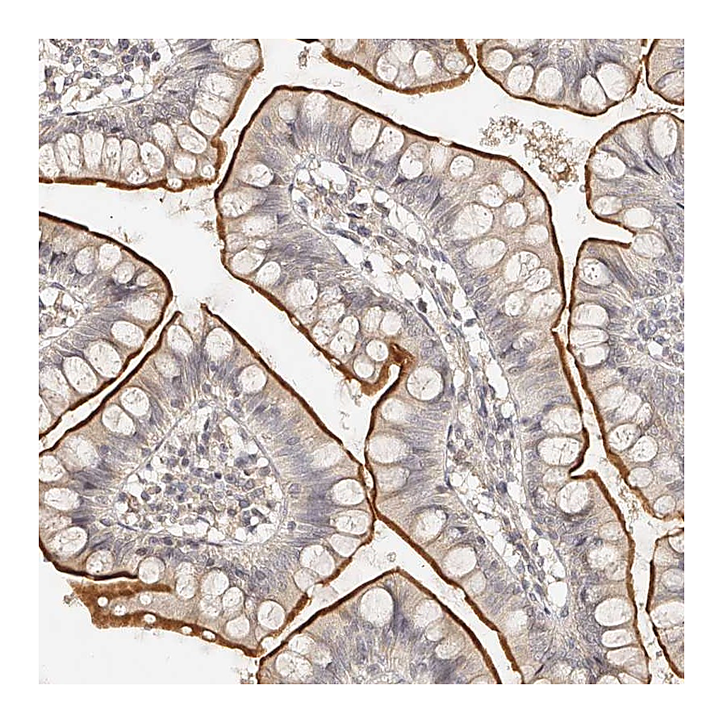 Atlas Antibodies Anti-ZNF789 Antibody