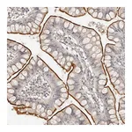 Atlas Antibodies Anti-ZNF789 Antibody