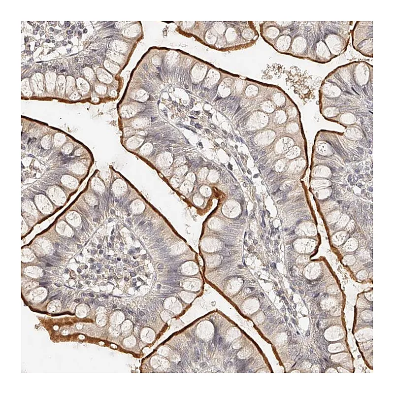 Atlas Antibodies Anti-ZNF789 Antibody