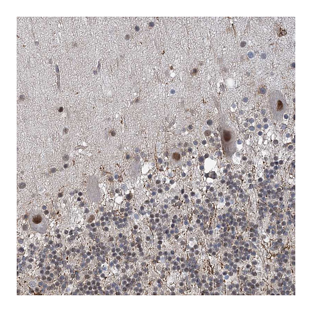 Atlas Antibodies Anti-ZNF8 Antibody