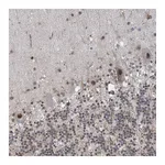 Atlas Antibodies Anti-ZNF8 Antibody