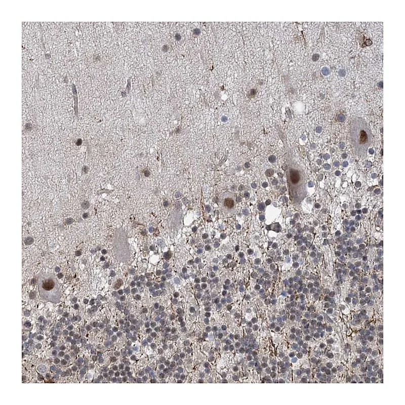 Atlas Antibodies Anti-ZNF8 Antibody