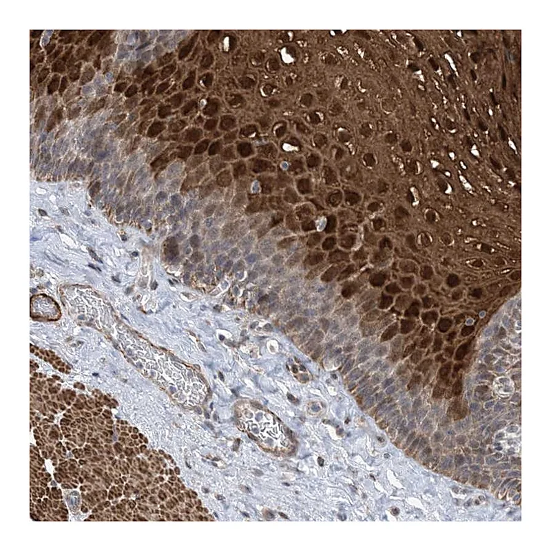 Atlas Antibodies Anti-ZNF8 Antibody