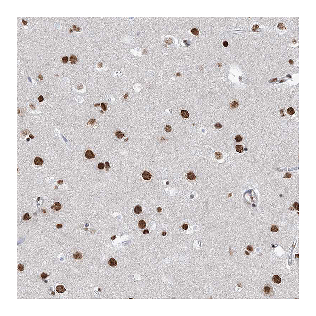 Atlas Antibodies Anti-ZNF792 Antibody