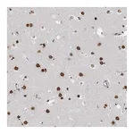 Atlas Antibodies Anti-ZNF792 Antibody