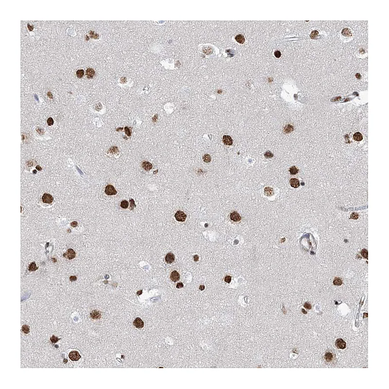 Atlas Antibodies Anti-ZNF792 Antibody