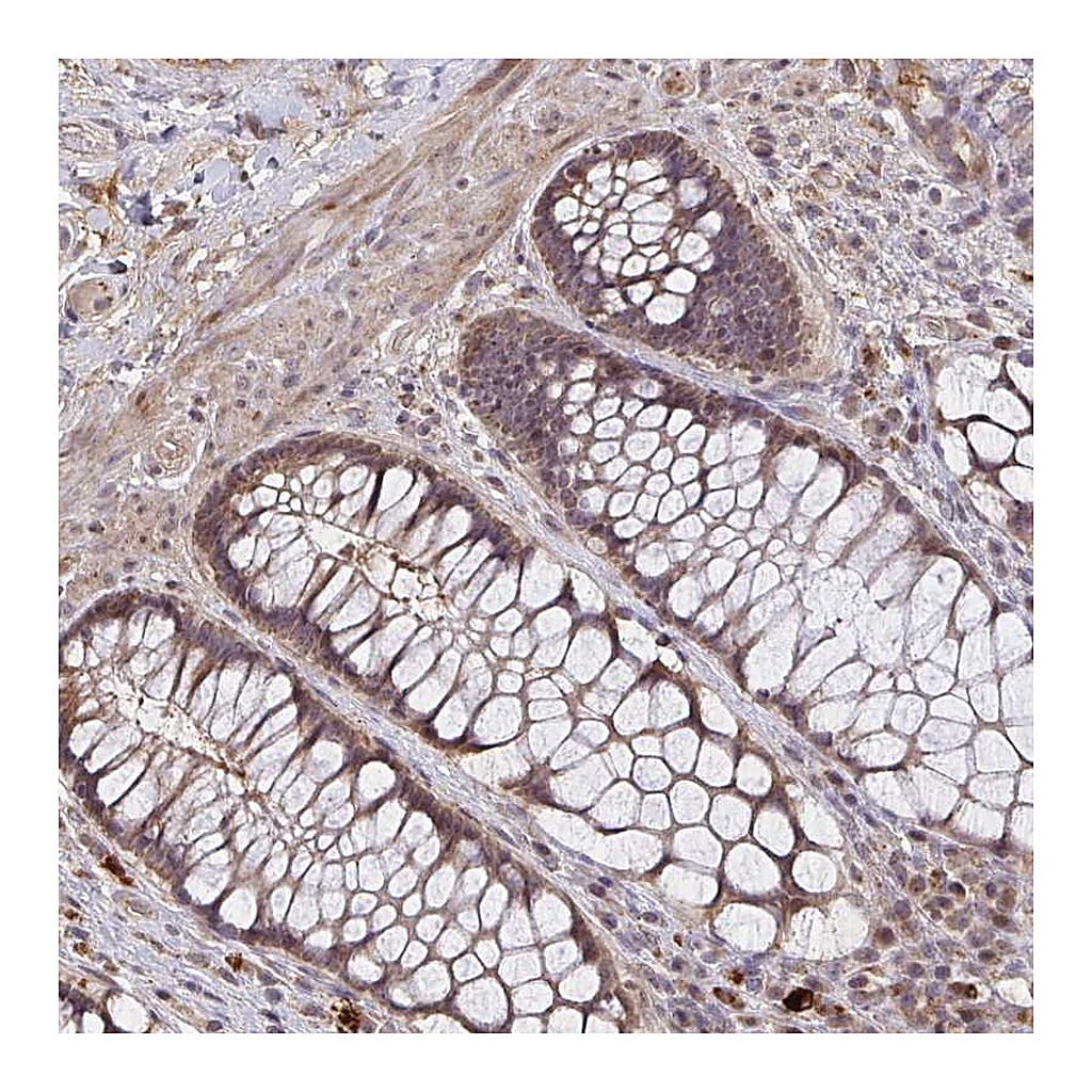 Atlas Antibodies Anti-ZNF805 Antibody