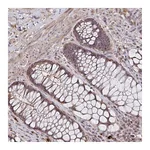 Atlas Antibodies Anti-ZNF805 Antibody