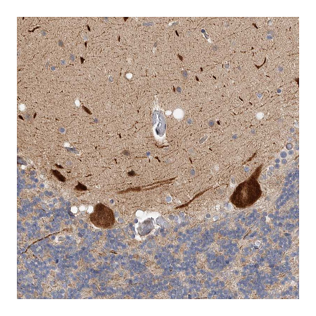 Atlas Antibodies Anti-ZNF804B Antibody