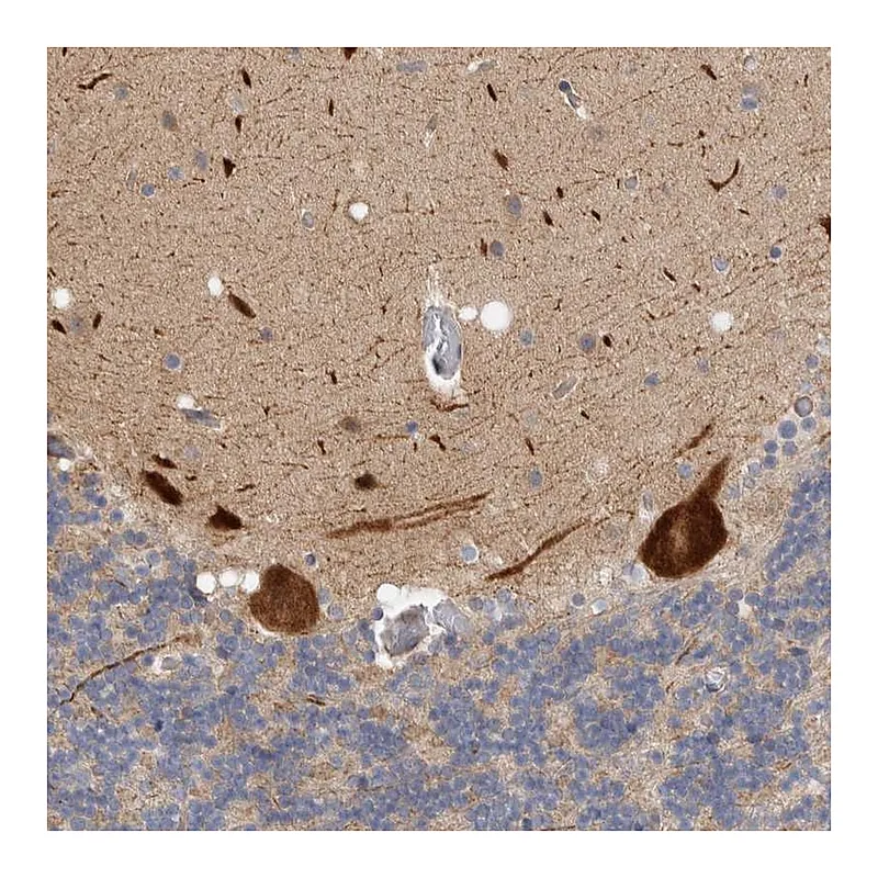 Atlas Antibodies Anti-ZNF804B Antibody