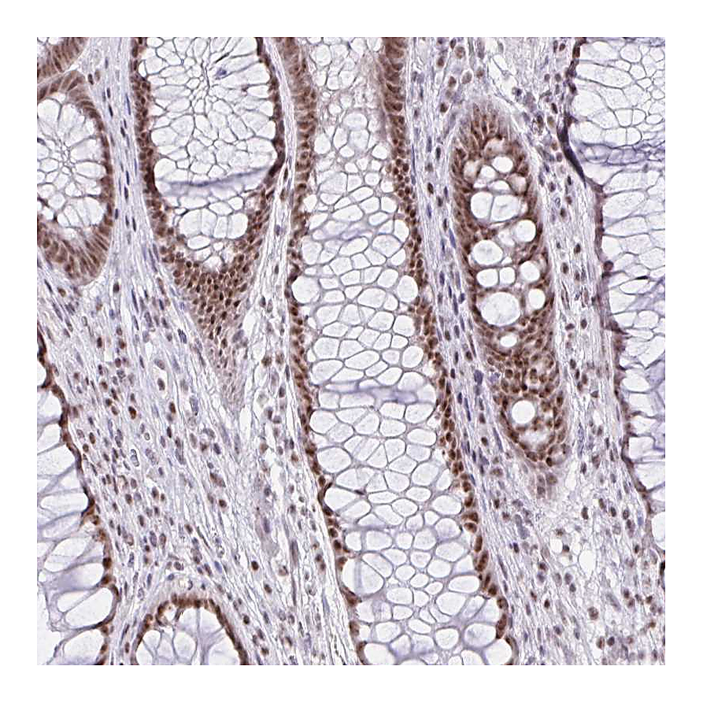 Atlas Antibodies Anti-ZNF800 Antibody