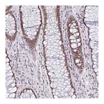 Atlas Antibodies Anti-ZNF800 Antibody