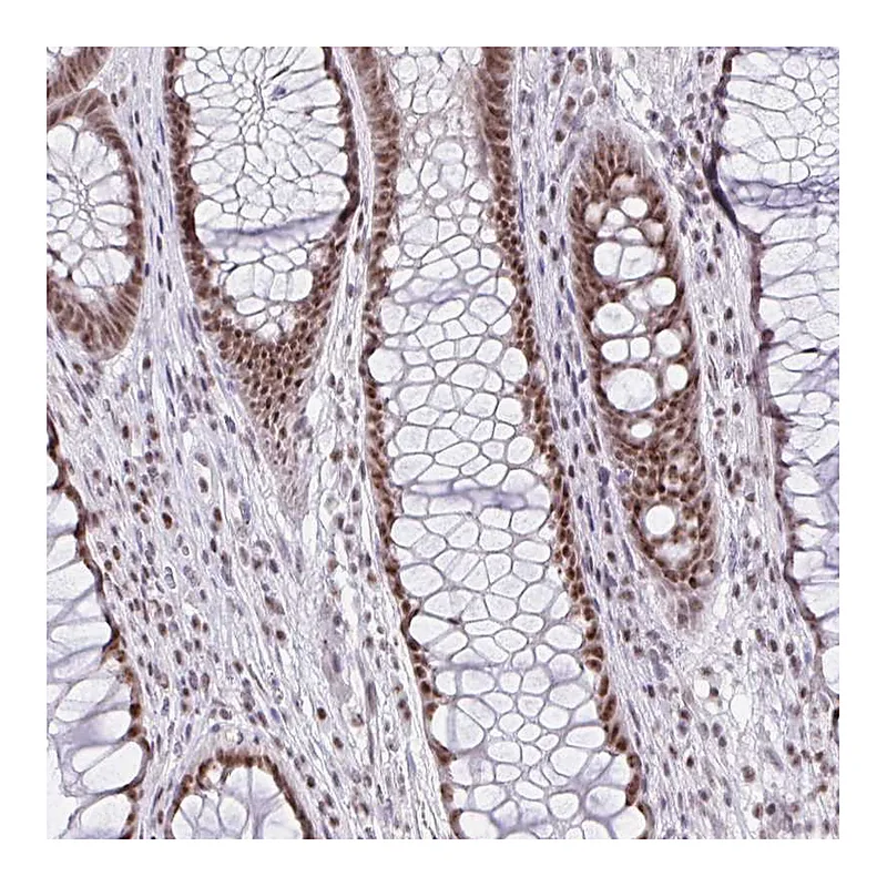 Atlas Antibodies Anti-ZNF800 Antibody