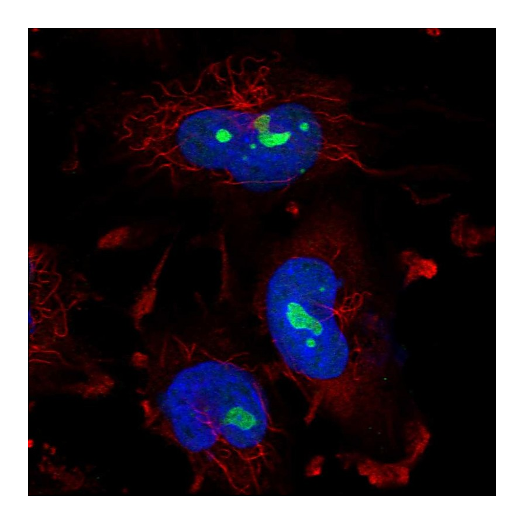 Atlas Antibodies Anti-ZNF800 Antibody