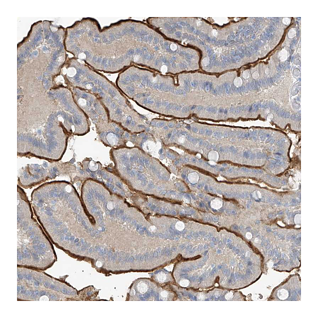 Atlas Antibodies Anti-ZNF793 Antibody