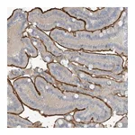 Atlas Antibodies Anti-ZNF793 Antibody