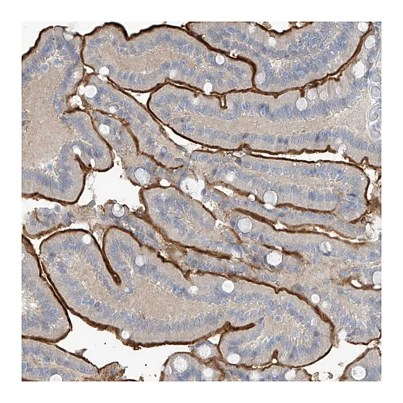 Atlas Antibodies Anti-ZNF793 Antibody