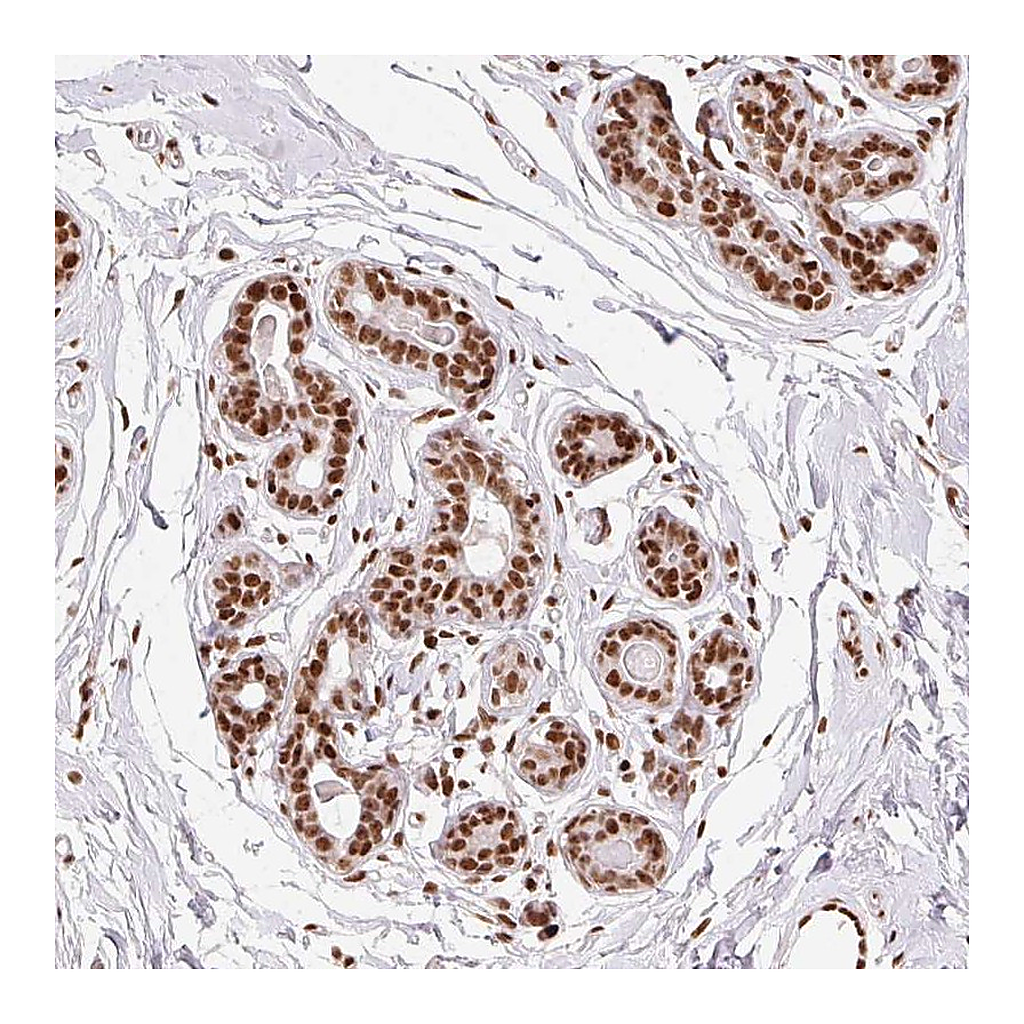Atlas Antibodies Anti-ZNF80 Antibody
