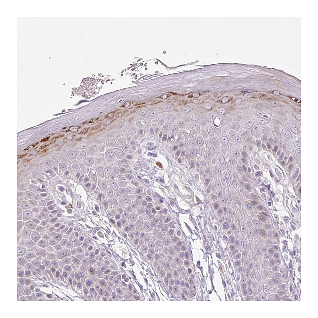 Atlas Antibodies Anti-ZNF814 Antibody