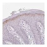 Atlas Antibodies Anti-ZNF814 Antibody