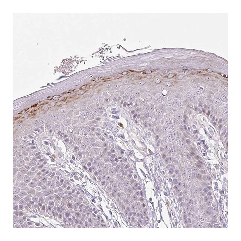 Atlas Antibodies Anti-ZNF814 Antibody