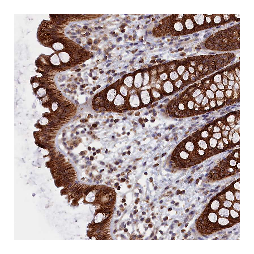 Atlas Antibodies Anti-ZNF816 Antibody
