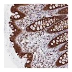 Atlas Antibodies Anti-ZNF816 Antibody