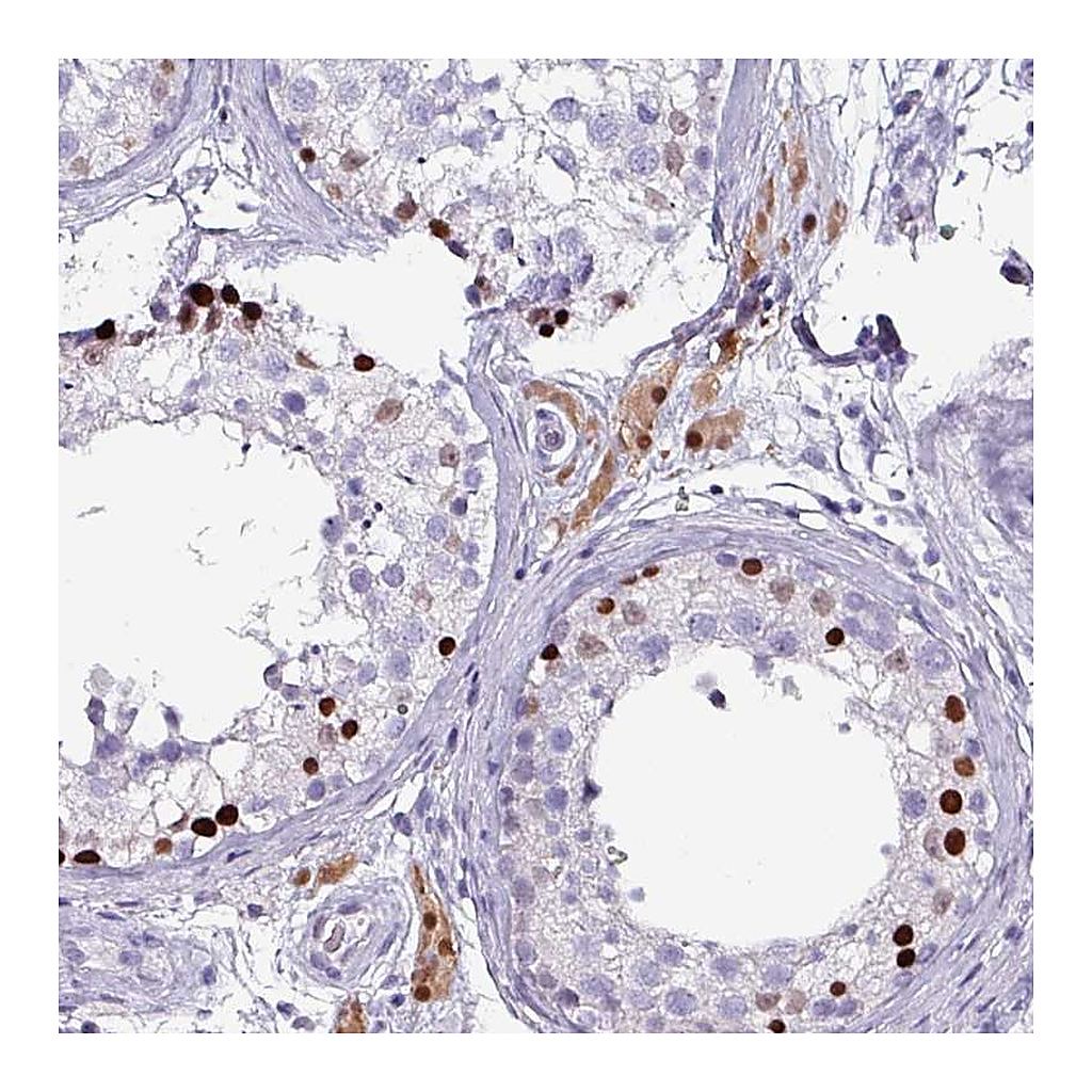 Atlas Antibodies Anti-ZNF816-ZNF321P Antibody