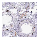 Atlas Antibodies Anti-ZNF816-ZNF321P Antibody