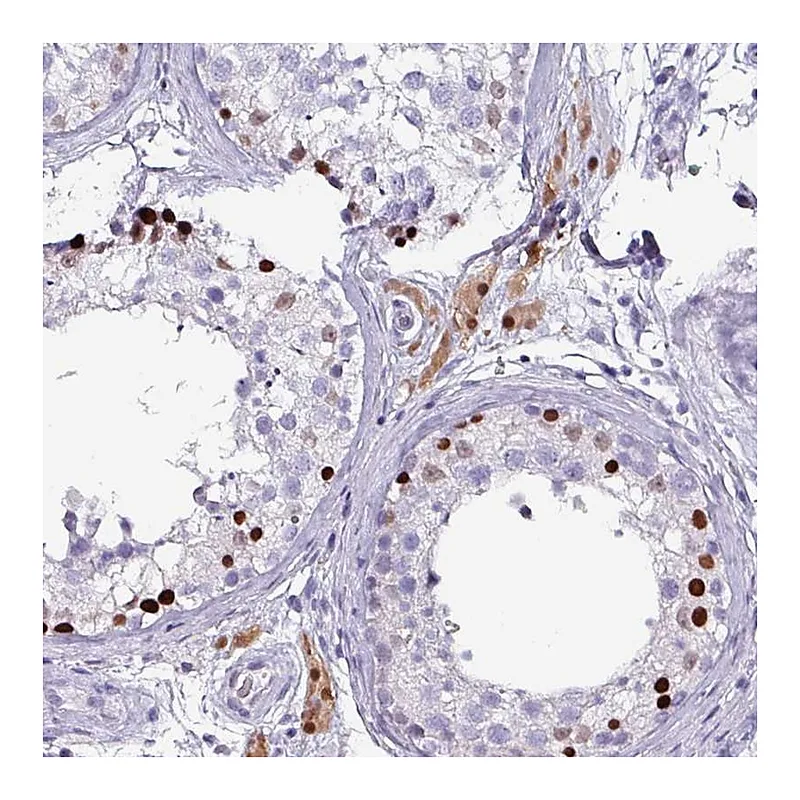 Atlas Antibodies Anti-ZNF816-ZNF321P Antibody