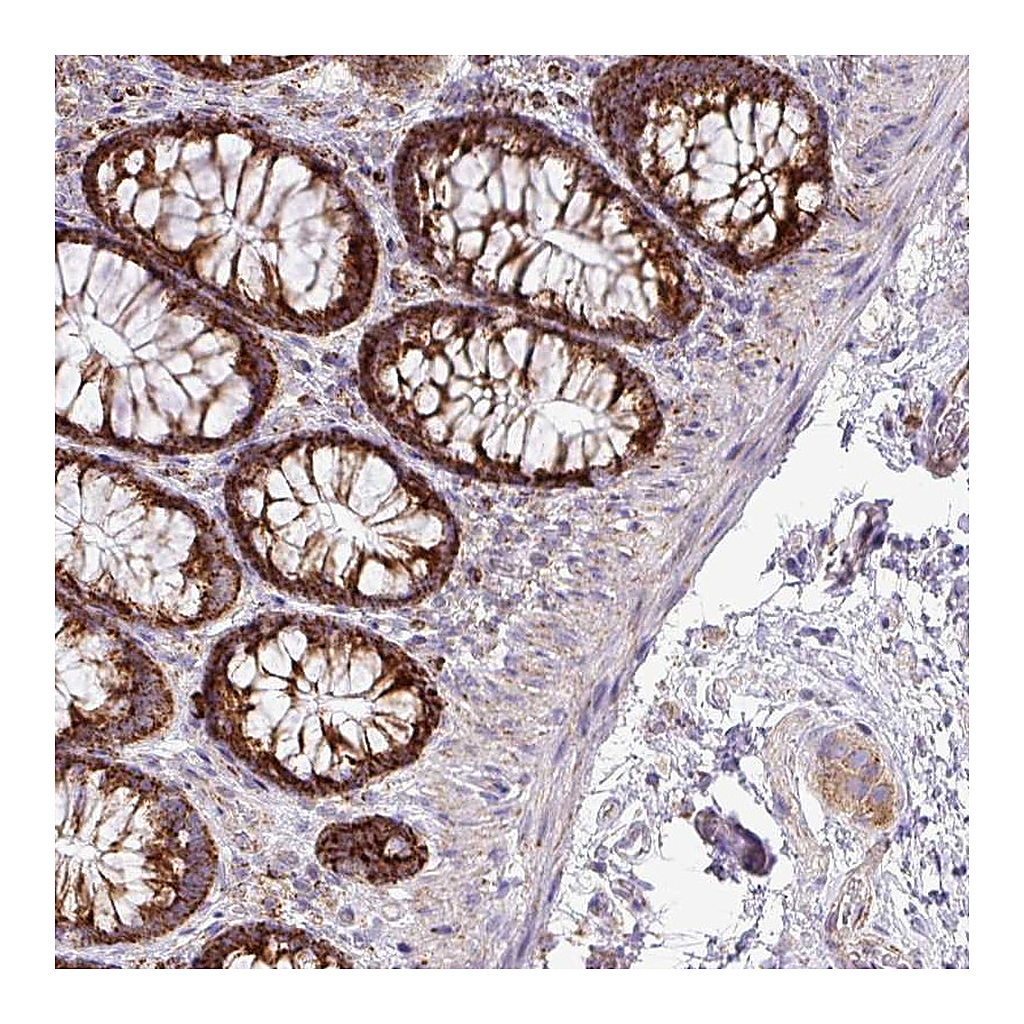 Atlas Antibodies Anti-ZNF81 Antibody