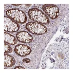 Atlas Antibodies Anti-ZNF81 Antibody