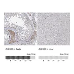 Atlas Antibodies Anti-ZNF821 Antibody