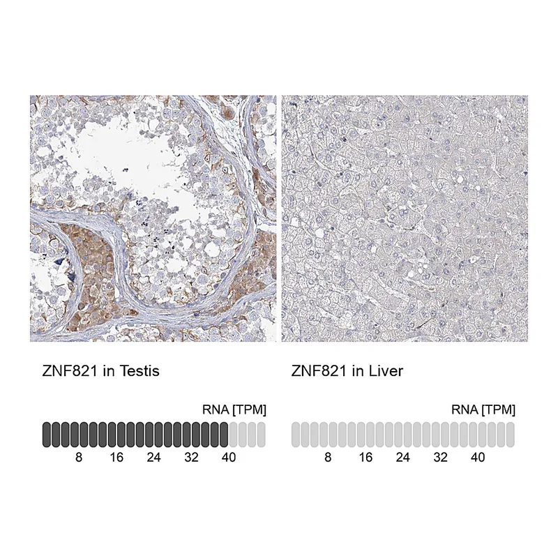 Atlas Antibodies Anti-ZNF821 Antibody
