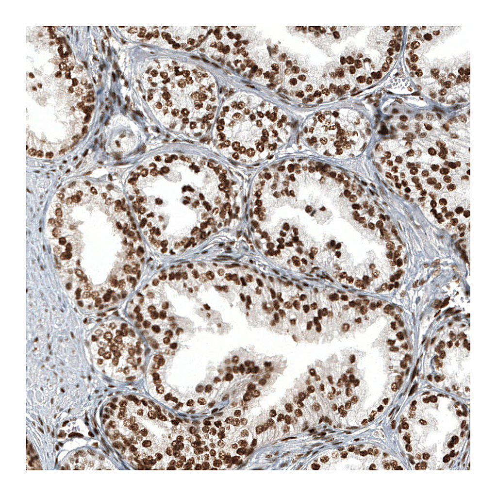 Atlas Antibodies Anti-ZNF827 Antibody