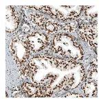 Atlas Antibodies Anti-ZNF827 Antibody